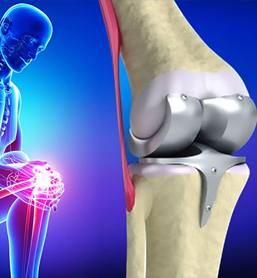 Kalça ve Diz Protezleri - Doç. Dr. Zafer SOYDAN