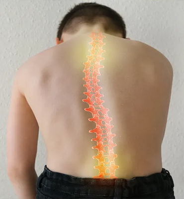 Omurga Hastalıklarının Tedavisi - Doç. Dr. Zafer SOYDAN