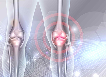 Kas-İskelet Sistemi Enfeksiyonları Tedavisi