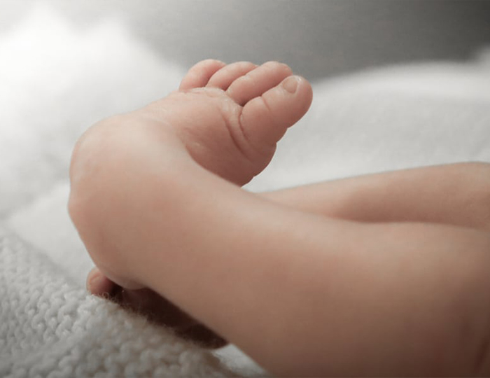 Doğuştan Ortopedik Bozukluklar