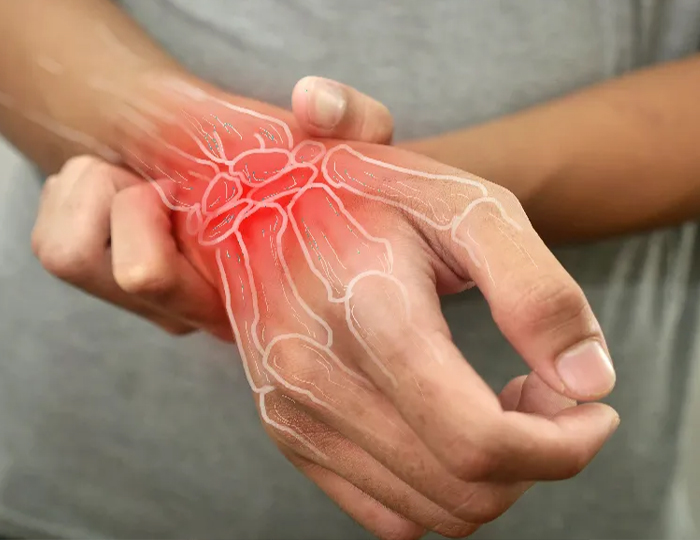 Eklem Hastalıkları