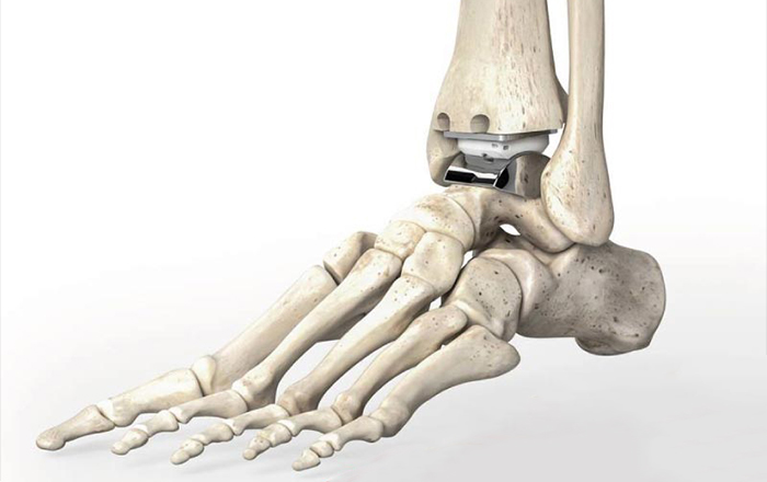 El Omuz Ayak Bileği Cerrahisi