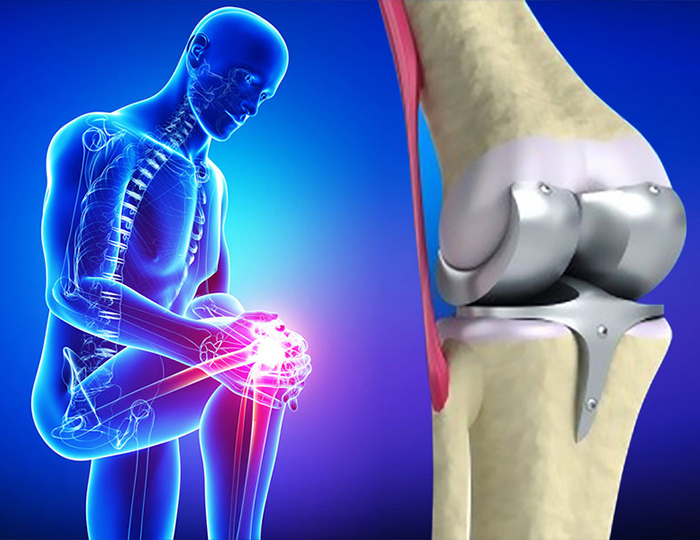 Kalça & Diz Protezleri