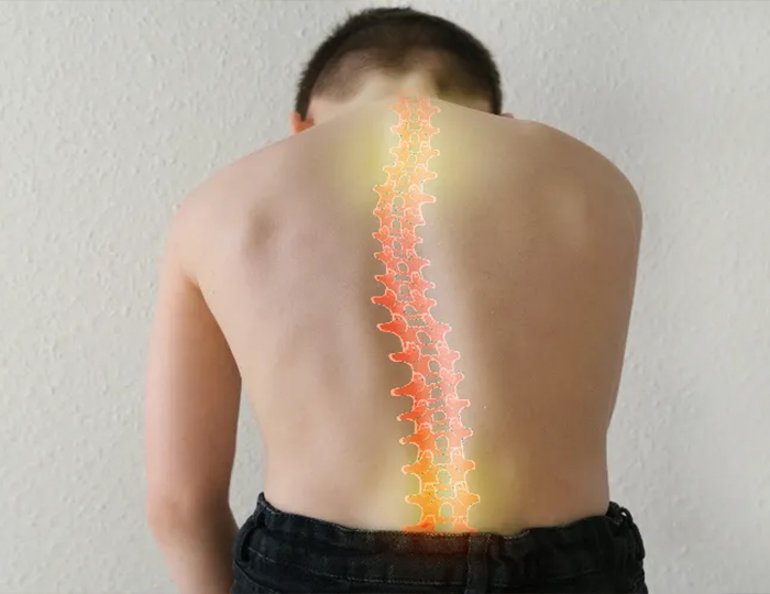 Omurga Hastalıkları